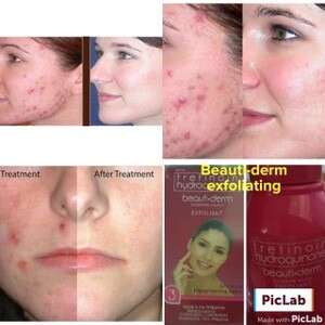 the skin is so thick and the skin is brown.