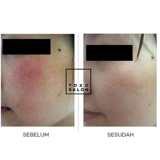 the girl's face is covered in a red skin