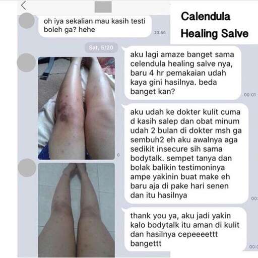 text messages from a friend who is missing her leg.