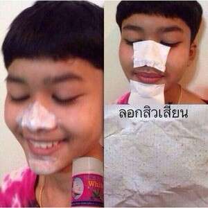 a girl with a bandage on her nose